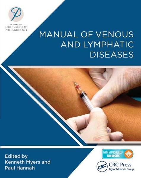 Manual of Venous and Lymphatic Diseases- International Shipping
